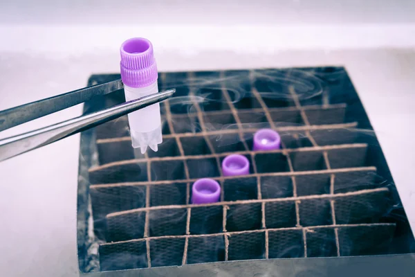 Tüp cryopreserved hücre süspansiyon ile düşük sıcaklık banka üzerinde tutan el
