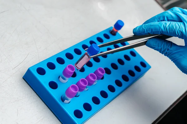 Χέρι που κρατά το σωλήνα με κρυοσυντηρημένων κυτταρικού αιωρήματος σε χαμηλή θερμοκρασία Τράπεζα — Φωτογραφία Αρχείου
