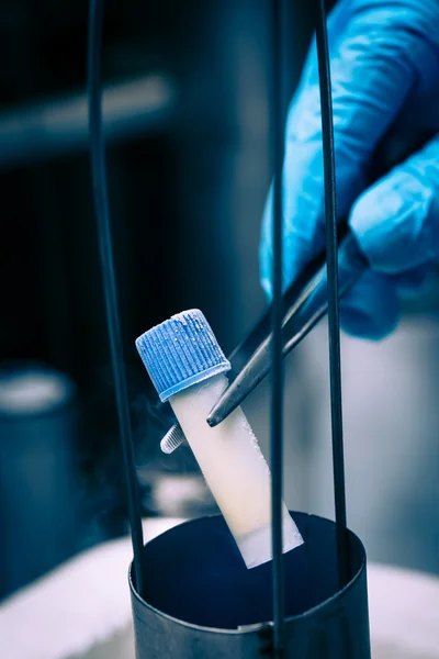 Hücre süspansiyon ve sperm cryobank üzerinde dondurma