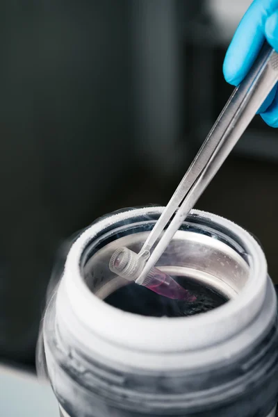 Wetenschapper bedrijf container met schorsing van stamcellen voor cryopreservatie. — Stockfoto