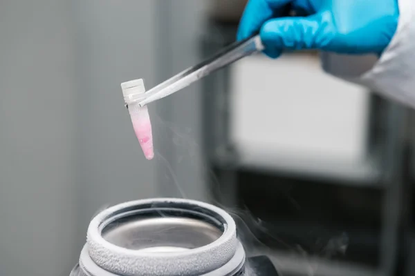 과학자 지주 컨테이너 cryopreservation 대 한 줄기 세포의 서 스 펜 션. — 스톡 사진