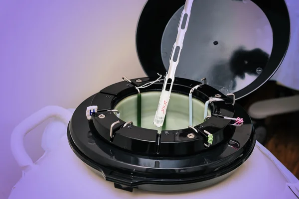 Sperm ve yumurta örnekleri içeren sıvı azot banka. Laboratuvar ekipmanları gübreleme, tüp bebek.
