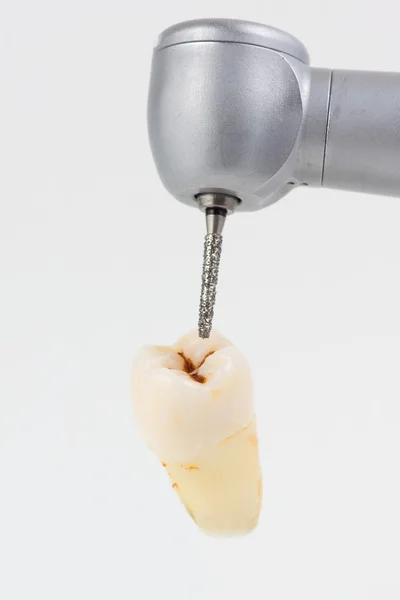 Наконечник зубной турбины — стоковое фото