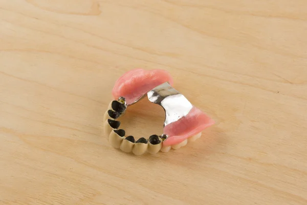 Prótesis dentales con coronas de metal-cerámica —  Fotos de Stock