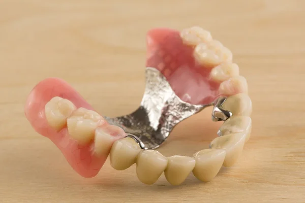 Dentures with metal-ceramic crowns — Stock Photo, Image