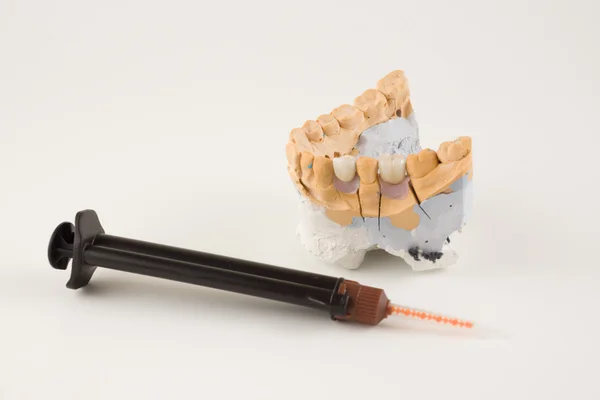 Dental prosthesis manufacturing step — Stock Photo, Image