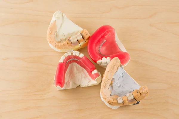 Dental prosthesis manufacturing step — Stock Photo, Image