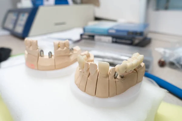 Lieu Travail Technicien Dentaire Pour Fabrication Prothèses Dentaires Sur Implant Photos De Stock Libres De Droits