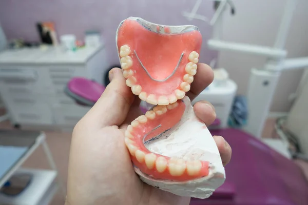 Próteses Dentárias Removíveis Completas Modelos Gesso Processo Fabricação — Fotografia de Stock