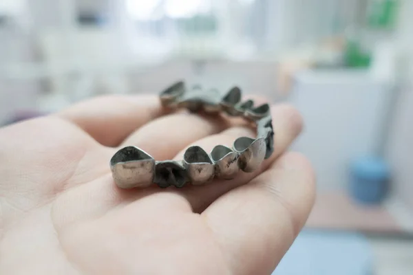 Metal Dental Bridge Manufacturing Process — Stock Photo, Image