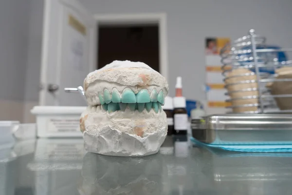 Modellierung Künstlicher Zähne Auf Einem Gipsmodell Zur Visuellen Darstellung — Stockfoto