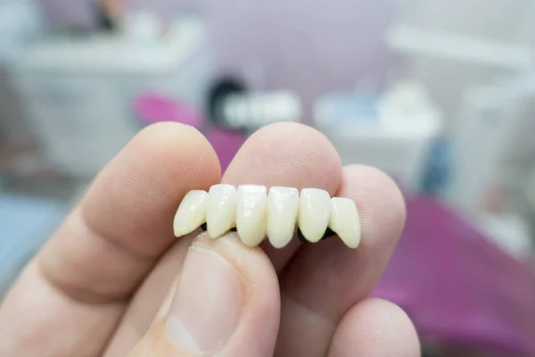 Pontes Metálicas Cerâmica Dental Nas Mãos Docto Imagens Royalty-Free