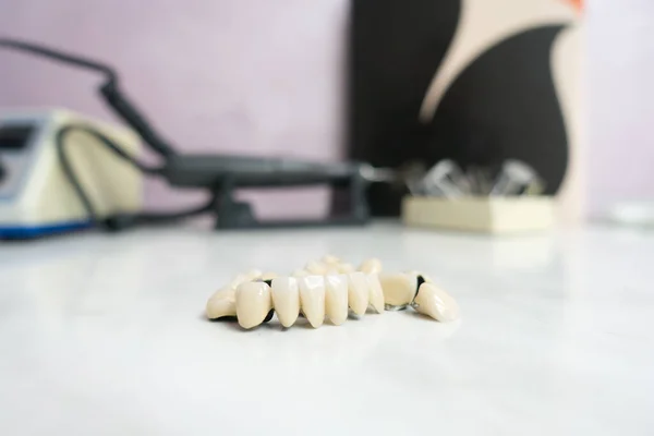 Dentystyczne Mosty Ceramiczne Metalowe Stole — Zdjęcie stockowe
