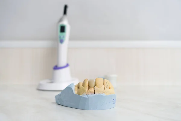 Dental Ceramic Crown Plaster Model Stands Tabl — Stock Photo, Image