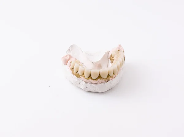 歯列模型 — ストック写真