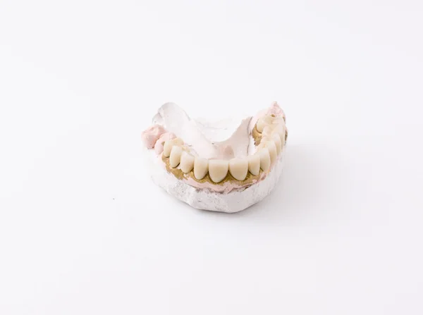 Modelo dentário — Fotografia de Stock