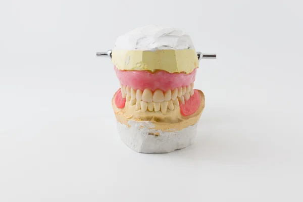 Dental model — Stock Photo, Image