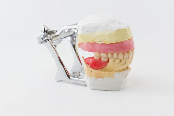 Dental model — Stock Photo, Image