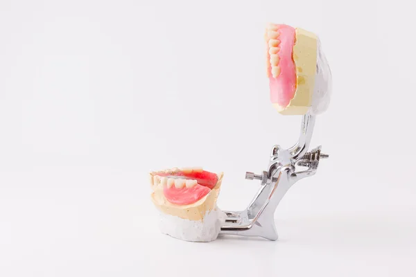 Dental model — Stock Photo, Image