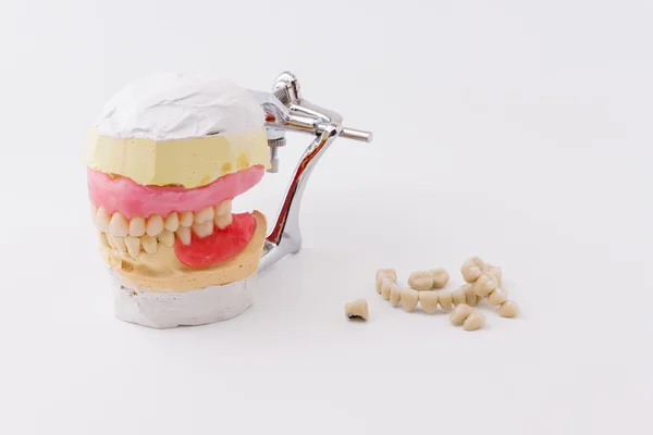 Dental model — Stock Photo, Image