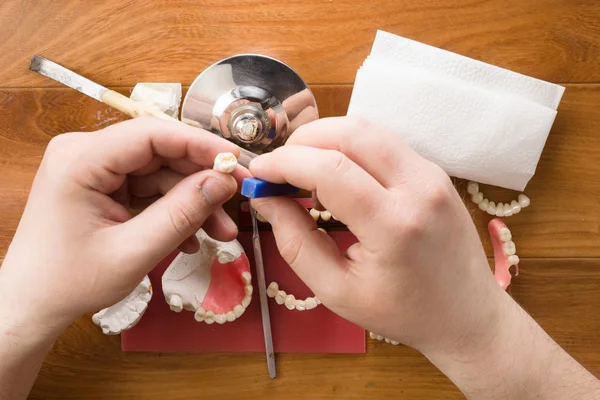 Lieu de travail du technicien dentaire avec les mains — Photo