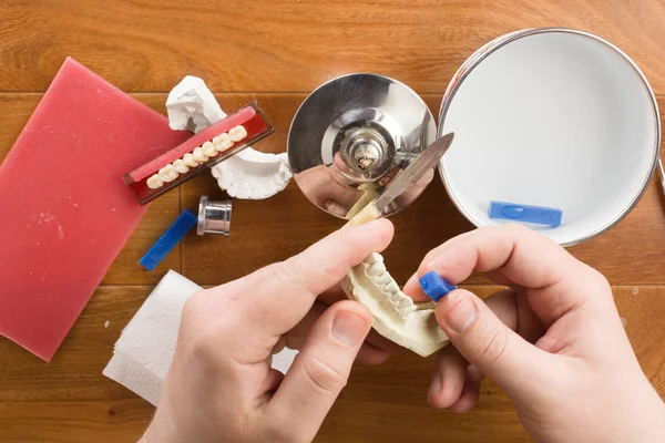 Lieu de travail du technicien dentaire avec les mains — Photo