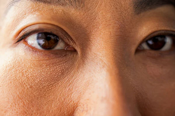 Asiatische Frau Mit Unteraugen Tasche Geschwollene Augen Von Mädchen Vorführung — Stockfoto