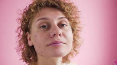 Yüzünde sivilce izi olan bir kadın çiçeklerle fotoğraflanır.