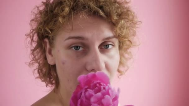 Kobieta Blizną Trądziku Twarzy Jest Fotografowany Kwiatami — Wideo stockowe