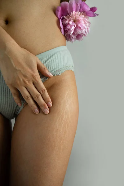 Cellulite Grassa Smagliatura Sulla Pelle Abbronzata Donna Gamba Casa Stile — Foto Stock