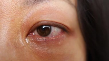 Asyalı kadın ağlıyor. Yakından Gözler ve Gözyaşları.