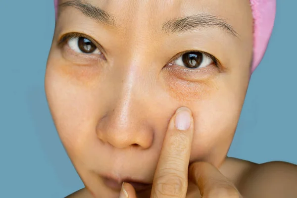 Asyalı Kadının Göz Torbası Sorunu Yüz Sorunu Cilt Sorunu Güzellik — Stok fotoğraf