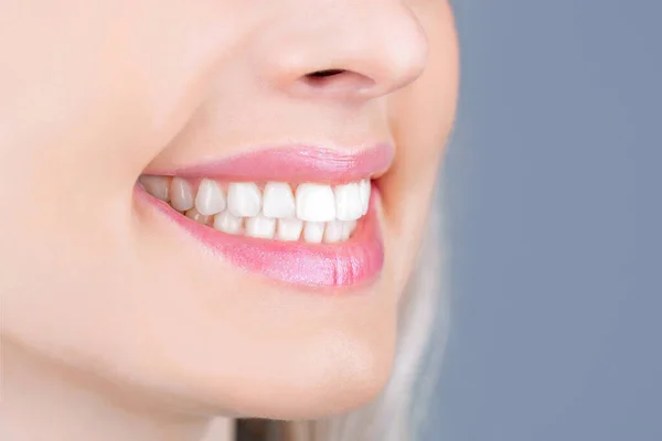 Sbiancamento dei denti. Concetto di salute dentale. procedura di sbiancamento dei denti. Cure dentali. Il concetto di odontoiatria. Denti sani perfetti. Primo piano colpo di donne dente sorriso. Perfetti denti sani sorridere donna — Foto Stock