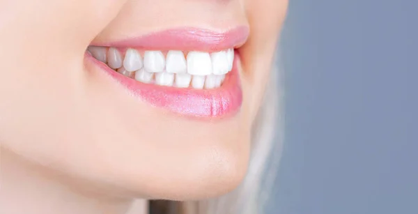 Οδοντιατρική περίθαλψη. Οδοντιατρική έννοια. Τέλεια υγιή δόντια. Κοντινό πλάνο των γυναικών με χαμόγελο στα δόντια. Τέλεια υγιή δόντια γυναίκα χαμόγελο. Λεύκανση δοντιών. Οδοντική υγεία. Διαδικασία λεύκανσης δοντιών — Φωτογραφία Αρχείου