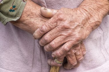 Yaşlanma süreci - çok yaşlı yaşlı kadın elleri buruşuk cilt