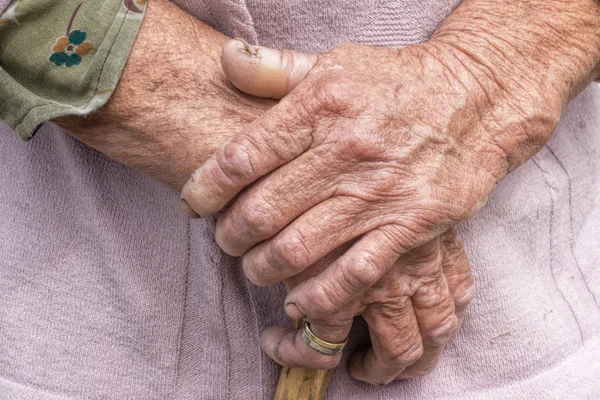 Åldrande process - mycket gammal äldre kvinna händer rynkig hud — Stockfoto