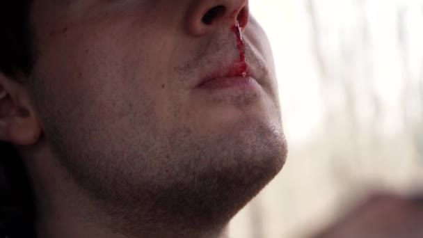 El hombre sentado en el coche está sangrando por la nariz — Vídeo de stock