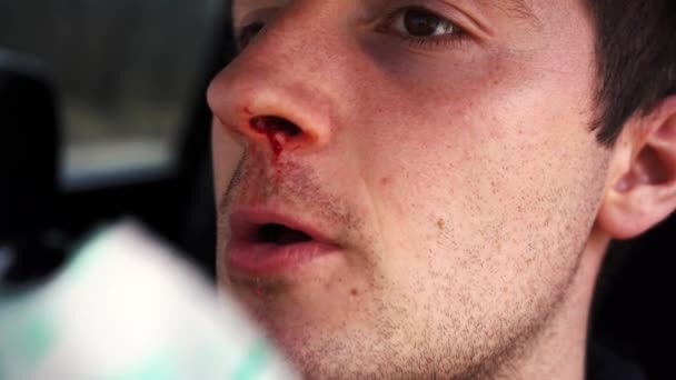 Un hombre elige una hemorragia nasal en servilletas — Vídeo de stock