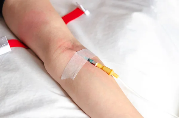 Intravenous drip in the hospital emergency room for first aid. health
