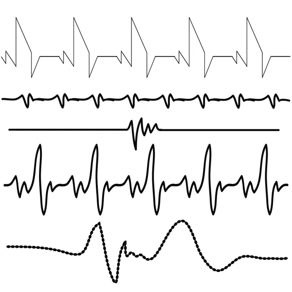 Elektrokardiogramm — Stockvektor