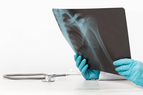 Omuz rahatsızlığı olan kadın doktorların elleri röntgen filmi çekiyor. Kemik sağlığı, etki. Ortopedi ilacı. Sağlık ve ilaç servisi. Sakatlık. SLAP lezyonu. Tıbbi Sancak