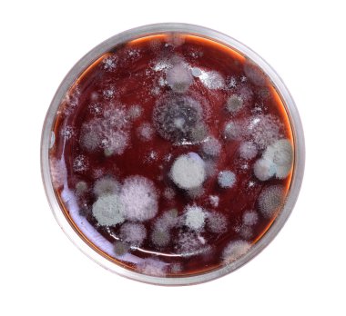 Petri dish ile kalıp