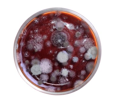 Petri dish with mold clipart