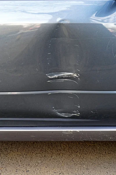 Car dent damage — Stock Photo, Image
