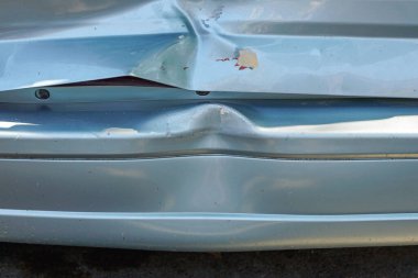 Araba vücut dent trafik kaza hasar