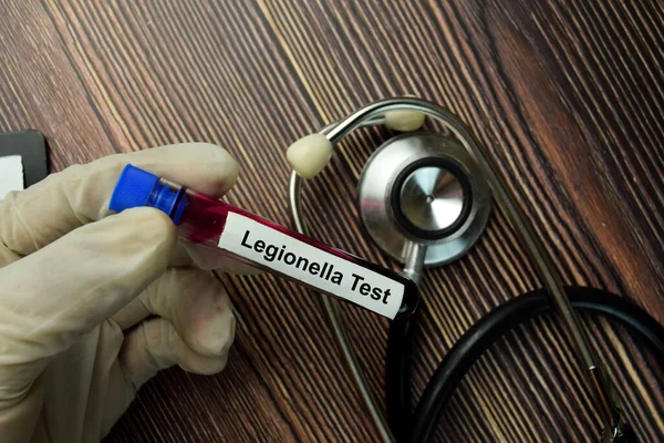 Legionella Examen Texto Con Muestra Sangre Vista Superior Aislada Sobre — Foto de Stock