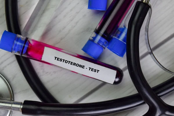 Testoterone Test Avec Échantillon Sang Vue Dessus Isolée Sur Bureau — Photo