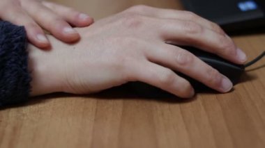 Yetişkin bir kadında bilek tendoniti, bilgisayar faresinin ağır kullanımıyla oluşur. Buz tedavisi. Sıcak soğuk jel torbası.