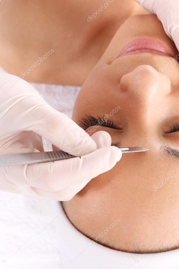 Exfoliating the skin with a scalpel