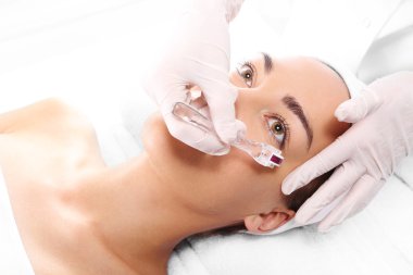 Mikro iğne Mezoterapi tedavisi